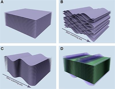 VivoFollow 2: Distortion-Free Multiphoton Intravital Imaging